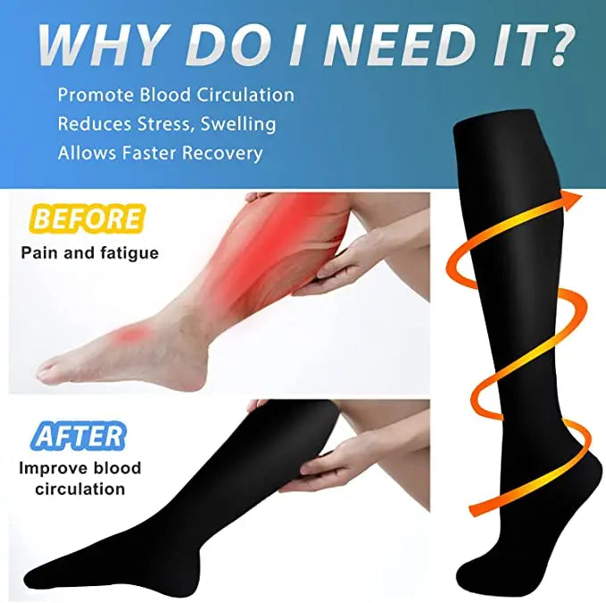Compression Socks - Prevent Varicose Veins