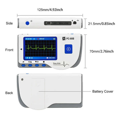 Handheld Portable ECG Monitor with Bluetooth & App Data Storage