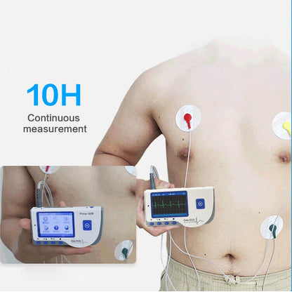 Handheld Portable ECG Monitor with Bluetooth & App Data Storage