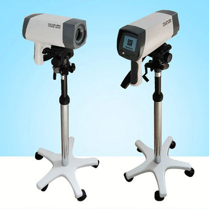 Digital Colposcope with HD Color Imaging & Display Screen – Gynecological Examination System