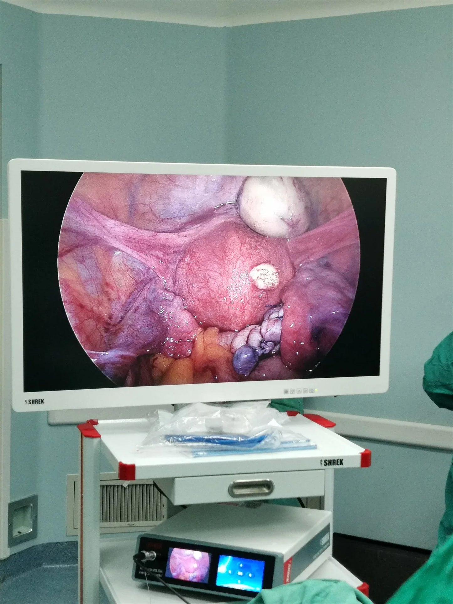 UHD 4K Endoscopic Imaging System