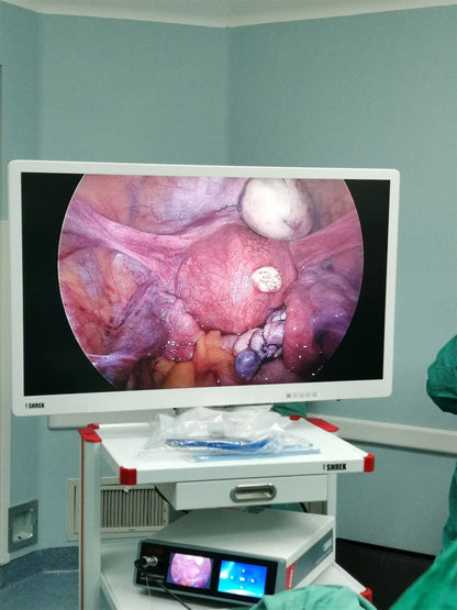 UHD 4K Endoscopic Imaging System