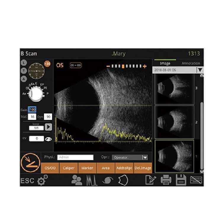 Portable Ophthalmic Ultrasound A/B Scan Machine