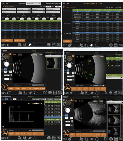 Portable Ophthalmic Ultrasound A/B Scan Machine