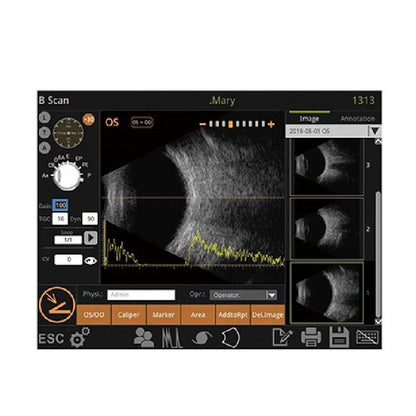 Portable Ophthalmic Ultrasound A/B Scan Machine