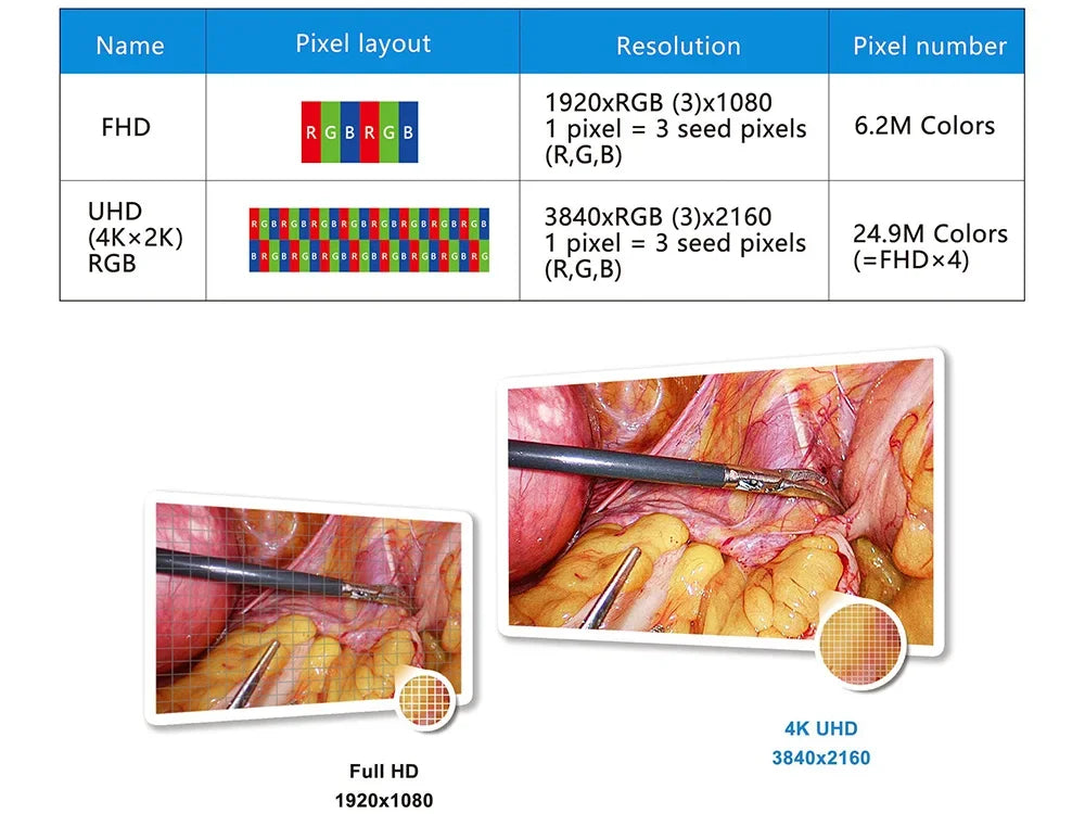 UHD 4K Endoscopic Imaging System