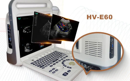 4D Veterinary Ultrasound Doppler Machine